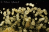 Klokdiertjes ( Vorticella spec.) tussen de draadwieren.